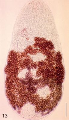 Metagonimus Miyatai -  Parasiteilla on ikioma sisäinen uima-allas ja ne saavat kylpyä aina, kun niiden isäntä liikkuu!